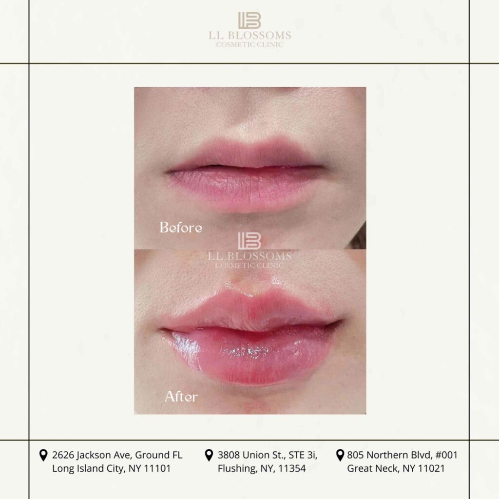 Before & after pt2 - 2