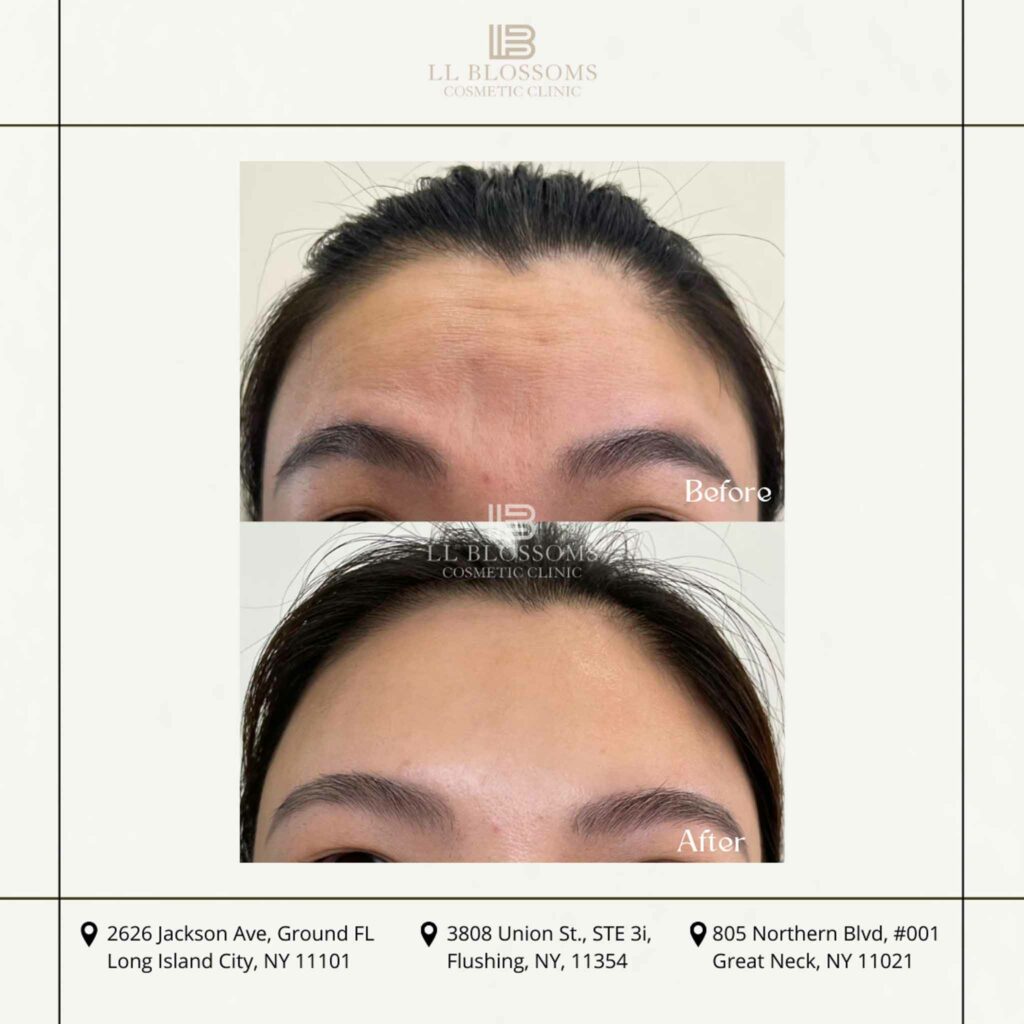 Before & after pt2 - 3