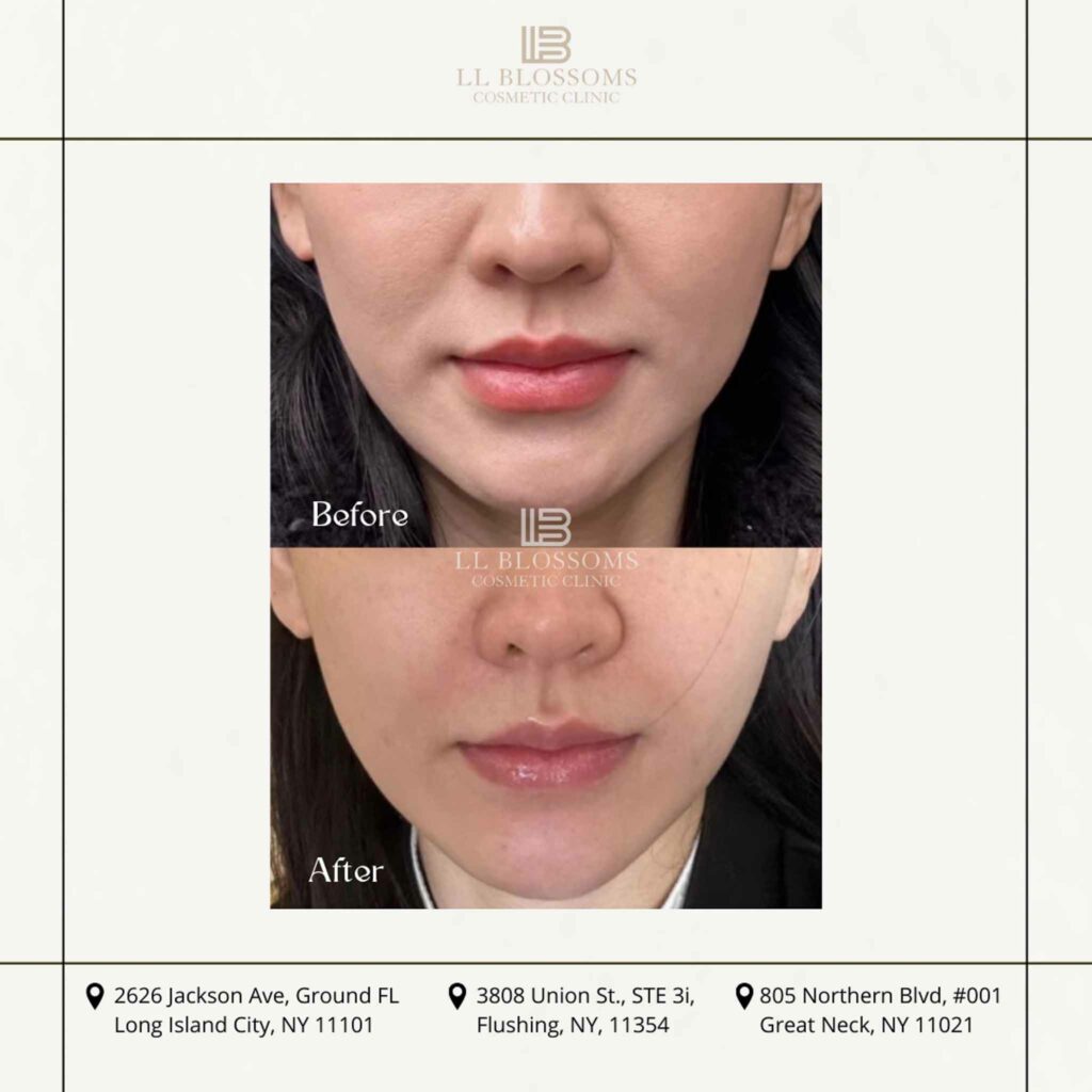 Before & after pt2 - 3