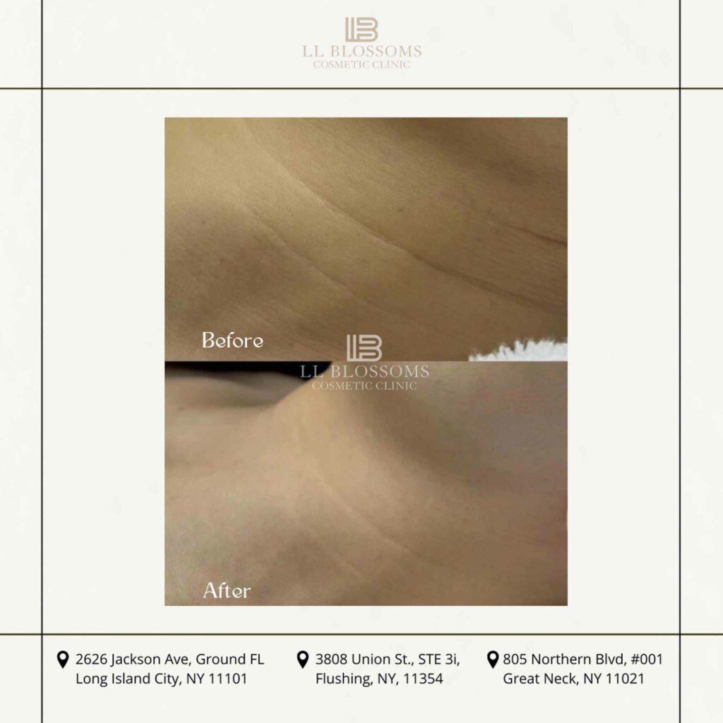 Before & after pt2 - 5