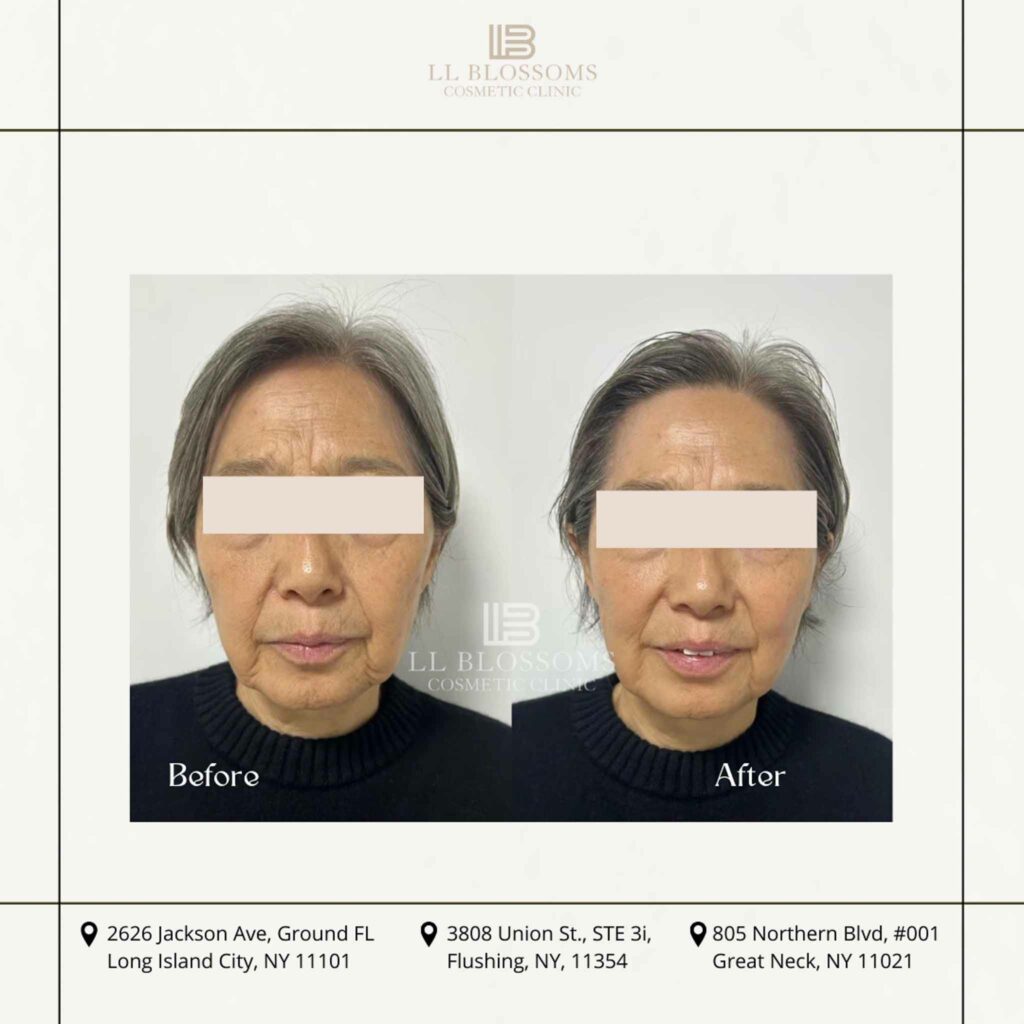 Before & after pt2 - 5