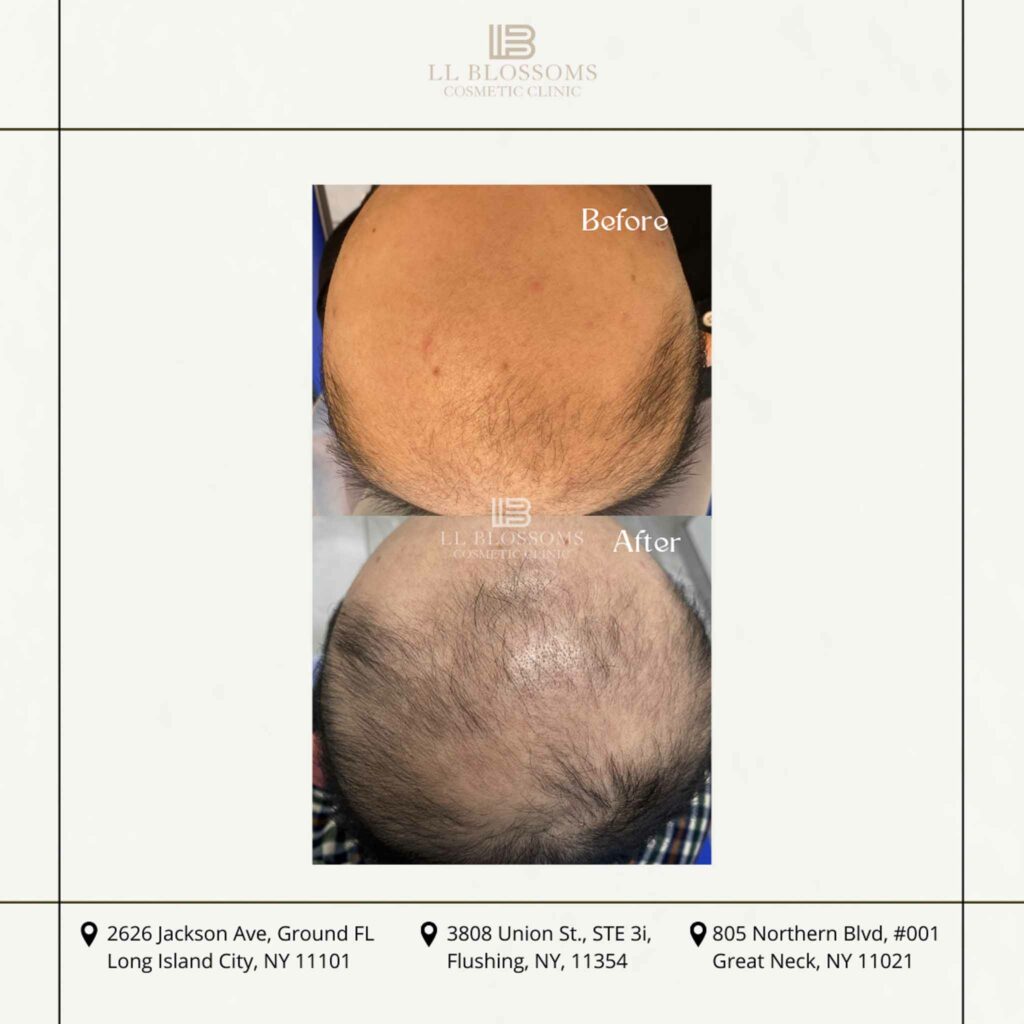 Before & after pt2 - 2