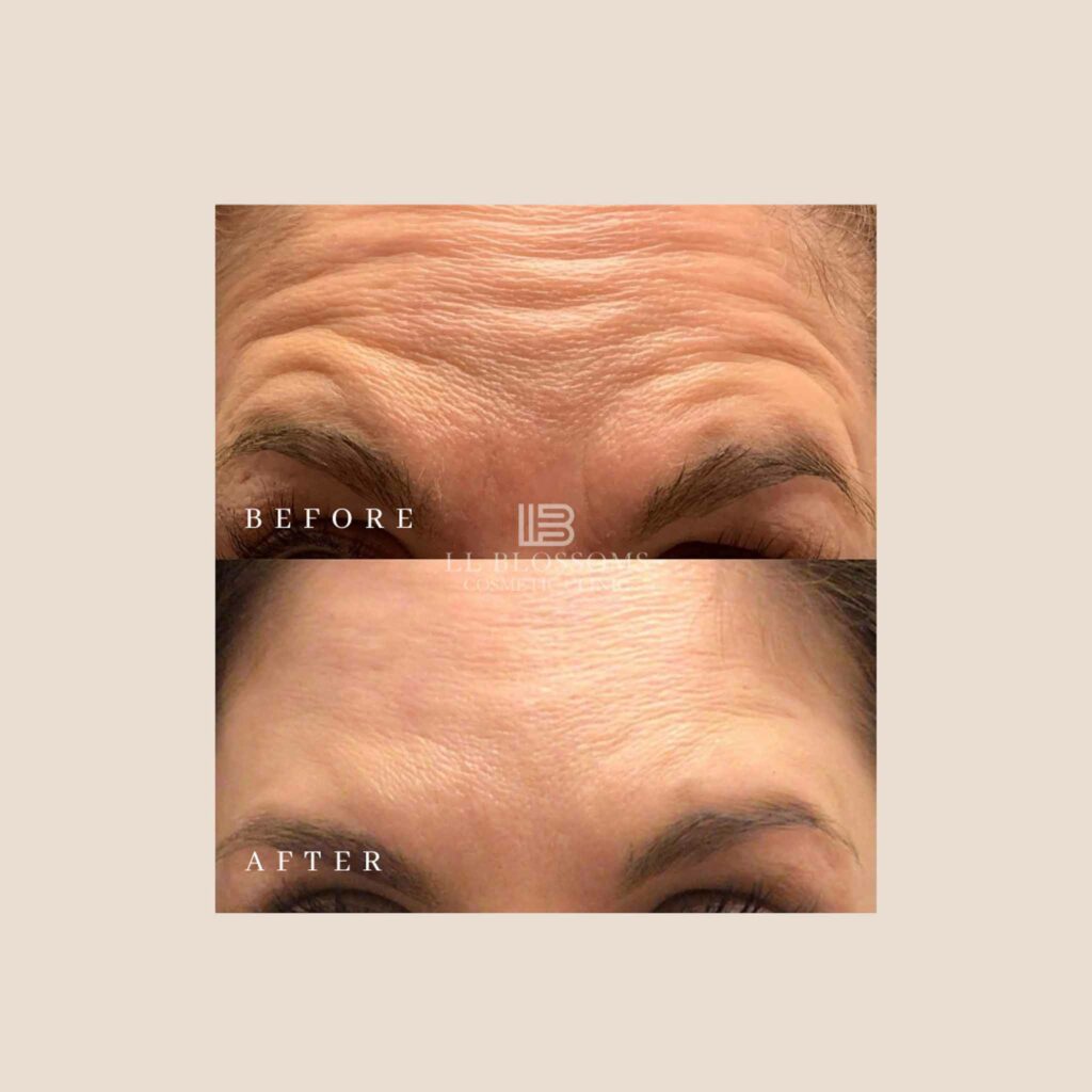 Instagram B/A Templates - Horizontal Template