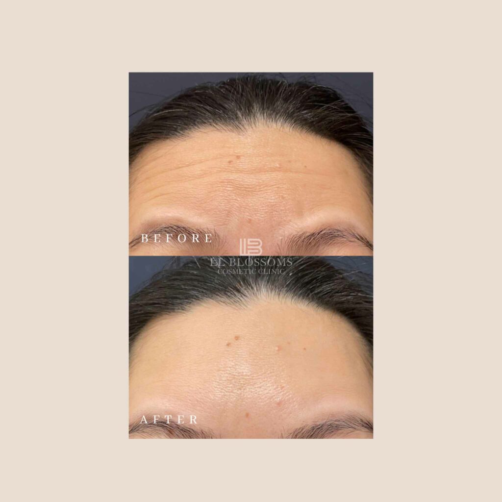 Instagram B/A Templates - Horizontal Template