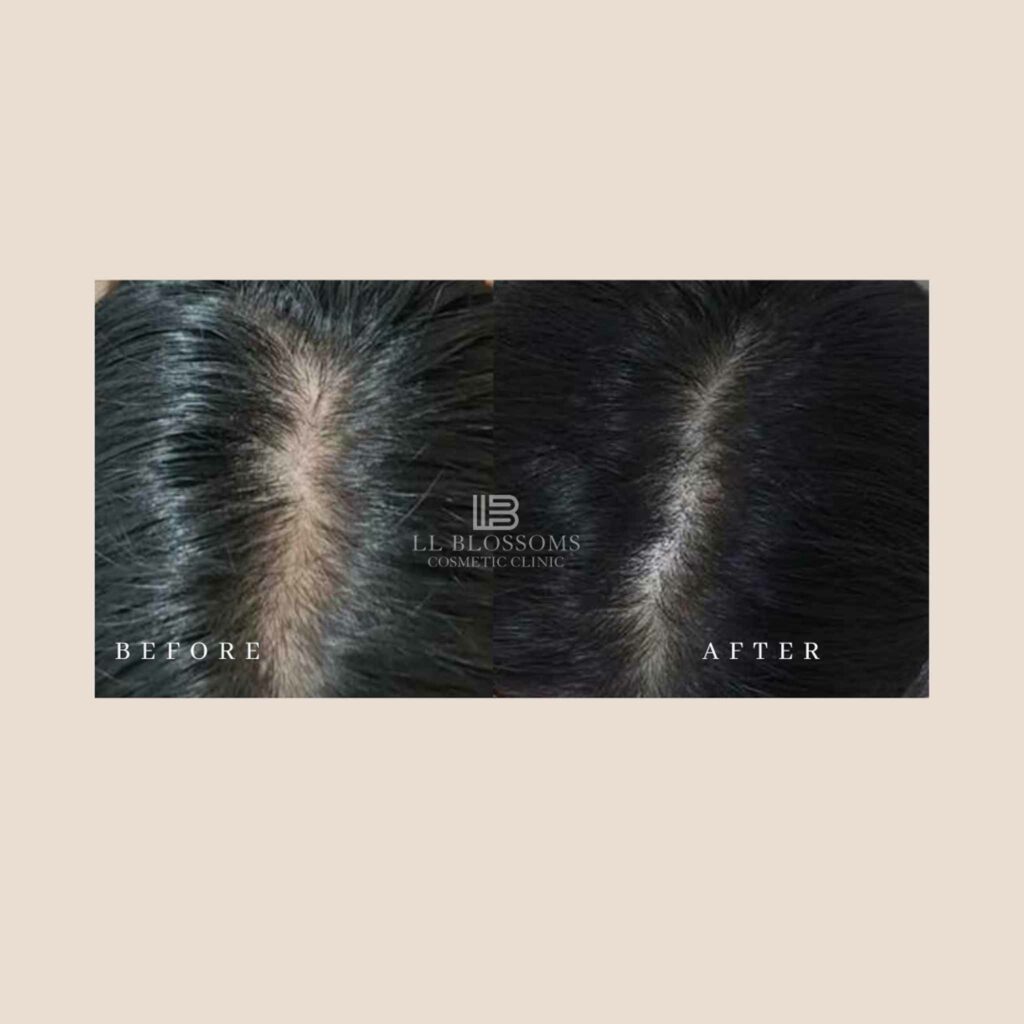 Instagram B/A Templates - Horizontal Template