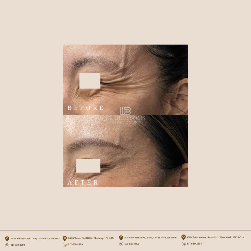 Copy of Instagram B/A Templates - Horizontal Template